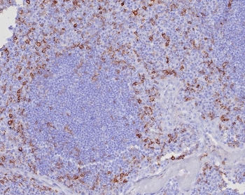 IHC staining of FFPE human tonsil tissue with CD162 antibody (clone PSGL1/8135R). HIER: boil tissue sections in pH 9 10mM Tris with 1mM EDTA for 20 min and allow to cool before testing.~