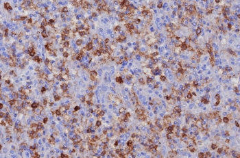 IHC staining of FFPE human spleen tissue with PSGL-1 antibody (clone PSGL1/8192R). HIER: boil tissue sections in pH 9 10mM Tris with 1mM EDTA for 20 min and allow to cool before testing.~