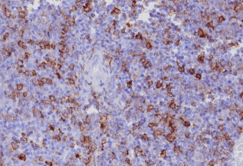 IHC staining of FFPE human tonsil tissue with PSGL-