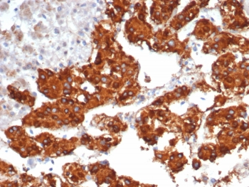 IHC staining of FFPE human adrenal gland tissue with Interleukin-31 antibody (clone IL31/7333). HIER: boil tissue sections in pH 9 10mM Tris with 1mM EDTA for 20 min and allow to cool before testing.~