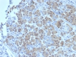 IHC staining of FFPE human salivary gland tissue with BRCA2 antibody (clone BRCA2/2158). HIER: boil tissue sections in pH 9 10mM Tris with 1mM EDTA for 20 min and allow to cool before testing.