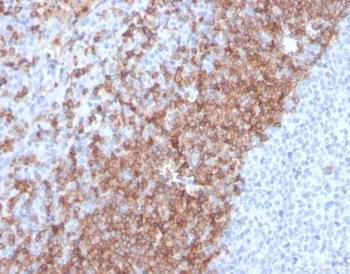 IHC staining of FFPE human tonsil tissue with IgD antibody (clone IGHD/2730R). HIER: boil tissue sections in pH 9 10mM Tris with 1mM EDTA for 20 min and allow to cool before testing.~