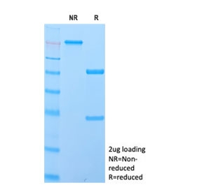 SDS-PAGE analysis of purified, BSA-free IgD antibody (c