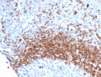 IHC staining of FFPE human tonsil tissue with recombinant IgD antibody (clone IGHD/6818R). Inset: PBS used in place of primary Ab (secondary Ab negative control). HIER: boil tissue sections in pH 9 10mM Tris with 1mM EDTA for 20 min and allow to cool before testing.~