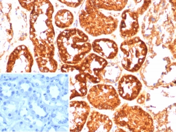 IHC staining of FFPE human kidne
