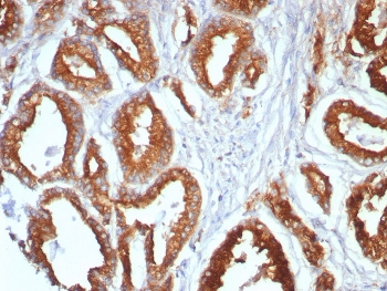 IHC staining of FFPE human prostate tissue with CD107a antibody (clone LAMP1/7456). HIER: boil tissue sections in pH 9 10mM Tris with 1mM EDTA for 20 min and allow to cool before testing.~