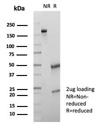 SDS-PAGE analysis of purified, BSA-free CD107a ant