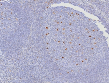 IHC staining of FFPE human tonsil tissue with CD10