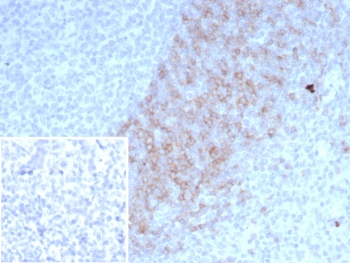 IHC staining of FFPE human lymph node tissue with IgD Heavy Chain antibody (clone IGHD/4967). Inset: PBS used in place of primary Ab (secondary Ab negative control). HIER: boil tissue sections in pH 9 10mM Tris with 1mM EDTA for 20 min and allow to cool before testing.~