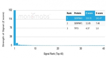 Analysis of a HuProt(TM) microarray containing more than 19,000 full-length human proteins using AAT antibody (AAT/4486). Z- and S- Score: The Z-score represents the strength of a signal that a monoclonal antibody (in combination with a fluorescently-tagged anti-IgG secondary antibody) produces when binding t