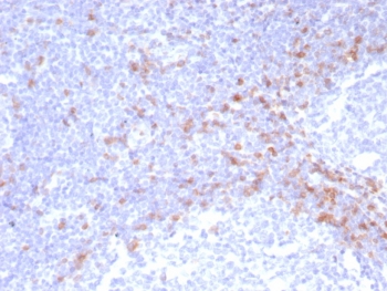 IHC staining of FFPE human tonsil tissue with recombinant IgD Heavy Chain antibody (clone IGHD/8228R). HIER: boil tissue sections in pH 9 10mM Tris with 1mM EDTA for 20 min and allow to cool before testing.~