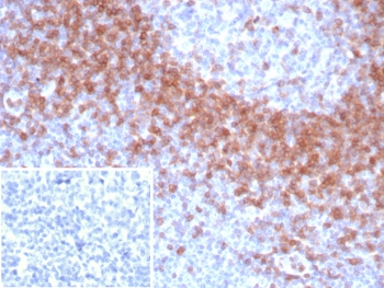 IHC staining of FFPE human tonsil tissue with IgD antibody (clone IGHD/8367R). Inset: PBS used in place of primary Ab (secondary Ab negative control). HIER: boil tissue sections in pH 9 10mM Tris with 1mM EDTA for 20 min and allow to cool before testing.~