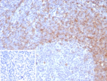 IHC staining of FFPE human tonsil tissue with IgD antibody (clone IGHD/8326R). Inset: PBS used in place of primary Ab (secondary Ab negative control). HIER: boil tissue sections in pH 9 10mM Tris with 1mM EDTA for 20 min and allow to cool before testing.~