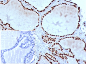 IHC staining of FFPE human thyroid tissue with TTF-1