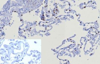 IHC staining of FFPE human lung tissue