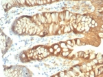 IHC staining of FFPE human colon tissue with recombinant LGALS3 antibody (clone rLGALS3/7286). HIER: boil tissue sections in pH 9 10mM Tris with 1mM EDTA for 20 min and allow to cool before testing.