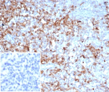 IHC staining of FFPE human tonsil tissue with SERPINA1 antibody (clone AAT/6325). Inset: PBS used in place of primary Ab (secondary Ab negative control). HIER: boil tissue sections in pH 9 10mM Tris with 1mM EDTA for 20 min and allow to cool before testing.~