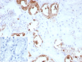 IHC staining of FFPE human kidney tissue with recombinant CKB antibody (clone rCKBB/8839). Inset: PBS used in place of primary Ab (secondary Ab negative control). HIER: boil tissue sections in pH 9 10mM Tris with 1mM EDTA for 20 min and allow to cool before testing.~