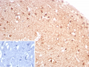 IHC staining of FFPE human brain tissue with recombinant CKBB antibody (clone rCKBB/8844). Inset: PBS used in place of primary Ab (secondary Ab negative control). HIER: boil tissue sections in pH 9 10mM Tris with 1mM EDTA for 20 min and allow to cool before testing.~