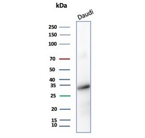 Western blot testing of human Daudi cell lysate with YY1 antibody (YY1/5436). Predicted molecular weight ~45 kDa but commonly observed at 45~65 kDa.~