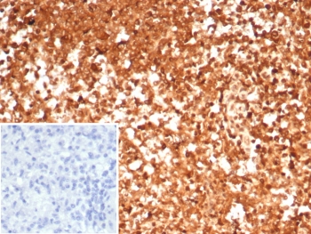 IHC staining of FFPE human spleen tissue with HSP90AA1 antibody (clone HSP90AA1/7426). Inset: PBS used in place of primary Ab (secondary Ab negative control). HIER: boil tissue sections in pH 9 10mM Tris with 1mM EDTA for 20 min and allow to cool before testing.~