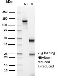 SDS-PAGE analysis of purified, BSA-free Creatine kinase B antibody (clone CKBB/6566) as confirmation o