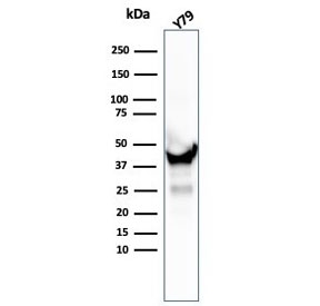 Western blot testing of human Y79 cell lysate with Creatine kinase B antibody (clone CKBB/6567). Predi