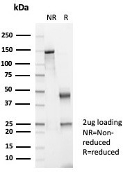 SDS-PAGE analysis of purified, BSA-free Brain Creatine Kinase antibody (clone CKBB/6568) as confir