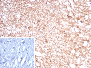 IHC staining of FFPE human brain tissue with recombinant Creatine kinase B antibody (clone rCKBB/8841). Inset: PBS used in place of primary Ab (secondary Ab negative control). HIER: boil tissue sections in pH 9 10mM Tris with 1mM EDTA for 20 min and allow to cool before testing.~