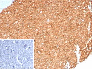 IHC staining of FFPE human brain tissue with recombinant Brain Creatine Kinase antibody (clone CKBB/8310R). Inset: PBS used in place of primary Ab (secondary Ab negative control). HIER: boil tissue sections in pH 9 10mM Tris with 1mM EDTA for 20 min and allow to cool before testing.~