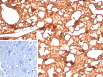 IHC staining of FFPE human brain tissue with Brain Creatine Kinase antibody (clone CKBB/8843R). Inset: PBS used in place of primary Ab (secondary Ab negative control). HIER: boil tissue sections in pH 9 10mM Tris with 1mM EDTA for 20 min and allow to cool before testing.~