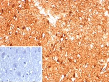 IHC staining of FFPE human brain tissue with Creatine phosphokinase BB antibody (clone CKBB/8609R). Inset: PBS used in place of primary Ab (secondary Ab negative control). HIER: boil tissue sections in pH 9 10mM Tris with 1mM EDTA for 20 min and allow to cool before testing.~