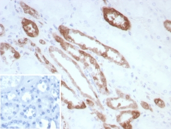 IHC staining of FFPE human kidney tissue with Creatine kinase B antibody (clone CKBB/8840R). Inset: PBS used in place of primary Ab (secondary Ab negative control). HIER: boil tissue sections in pH 9 10mM Tris with 1mM EDTA for 20 min and allow to cool before testing.~