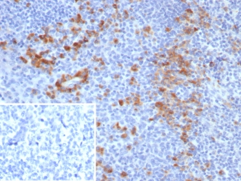 IHC staining of FFPE human tonsil tissue with B7-H3 antibody (clone B7H3/4479) at 2ug/ml. Inset: PBS used in place of primary Ab (secondary Ab negative control). HIER: boil tissue sections in pH 9 10mM Tris with 1mM EDTA for 20 min and allow to cool before testing.~