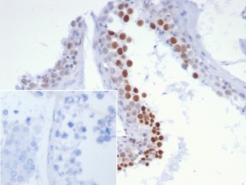 IHC staining of FFPE human testis tissue with NUT family member 1 antibody (clone SNUPN/7363R). Inset: PBS used in place of primary Ab (secondary Ab negative control). HIER: boil tissue sections in pH 9 10mM Tris with 1mM EDTA for 20 min and allow to cool before testing.~