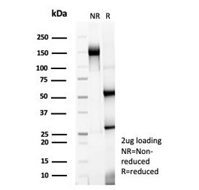 SDS-PAGE analysis of purified, BSA-free TrkC antibody (clone NTRK3/7140) as confirmation of integrity and purity.
