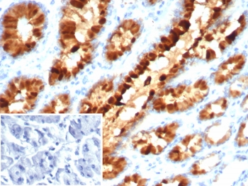IHC staining of FFPE human stomach tissue with Estrogen Inducible Protein pS2 antibody (clone TFF1/7891). Inset: PBS used in place of primary Ab (secondary Ab negative control). HIER: boil tissue sections in pH 9 10mM Tris with 1mM EDTA for 20 min and allow to cool before testing.~