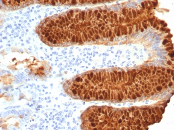 IHC staining of FFPE human stomach tissue with Estrogen Inducible Protein pS2 antibody (clone TF/7768). HIER: boil tissue sections in pH 9 10mM Tris with 1mM EDTA for 20 min and allow to cool before testing.~