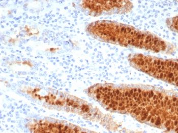 IHC staining of FFPE human stomach tissue with Estrogen Inducible Protein pS2 antibody (clone TF/7770). HIER: boil tissue sections in pH 9 10mM Tris with 1mM EDTA for 20 min and allow to cool before testing.~