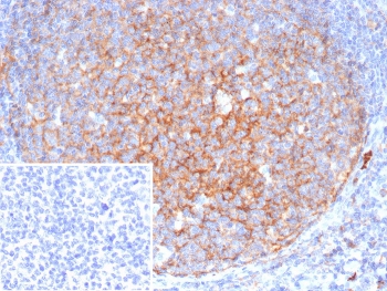 IHC staining of FFPE human spleen tissue with CD11b antibody (clone ITGAM/4741). Inset: PBS used in place of primary Ab (secondary Ab negative control). HIER: boil tissue sections in pH 9 10mM Tris with 1mM EDTA for 20 min and allow to cool before testing.~