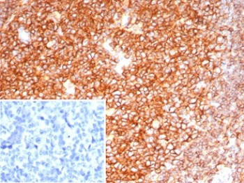 IHC staining of FFPE human tonsil tissue with CD19 antibody (clone CD19/7665). HIER: boil tissue sections in pH 9 10mM Tris with 1mM EDTA for 20 min and allow to cool before testing.~