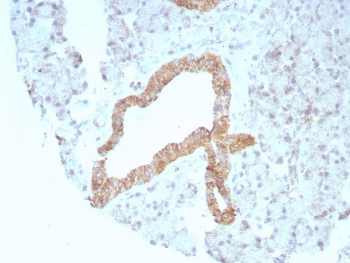 IHC staining of FFPE human prostate tissue with recombinant CD269 antibody (clone rCD269/8507). HIER: boil tissue sections in pH 9 10mM Tris with 1mM EDTA for 20 min and allow to cool before testing.~