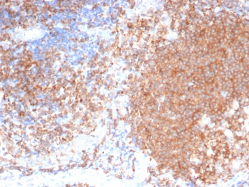 IHC staining of FFPE human tonsil tissue with Polo like kinase 1 antibody (clone PLK1/7122). HIER: boil tissue sections in pH 9 10mM Tris with 1mM EDTA for 20 min and allow to cool before testing.~