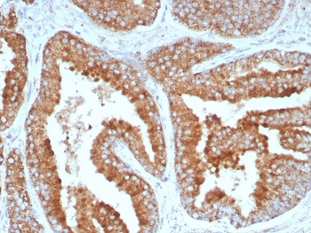 IHC staining of FFPE human prostate tissue with CD269 antibody (clone CD269/8508R). HIER: boil tissue sections in pH 9 10mM Tris with 1mM EDTA for 20 min and allow to cool before testing.~