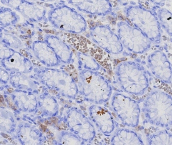 IHC staining of FFPE human stomach (corpus) with recombinant BCMA antibody (clone CD269/7986R). HIER: boil tissue sections in pH 9 10mM Tris with 1mM EDTA for 20 min and allow to cool before testing.~