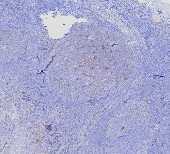 IHC staining of FFPE human tonsil tiss