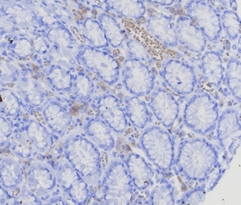 IHC staining of FFPE human stomach (corpus) with BCMA antibody (clone CD269/8125R). HIER: boil tissue sections in pH 9 10mM Tris with 1mM EDTA for 20 min and allow to cool before testing.~