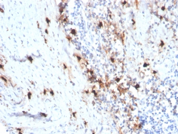 IHC staining of FFPE human tonsil tissue with recombinant TPSAB1 antibody (clone rTPSAB1/1963). HIER: boil tissue sections in pH 9 10mM Tris with 1mM EDTA for 20 min and allow to cool before testing.~