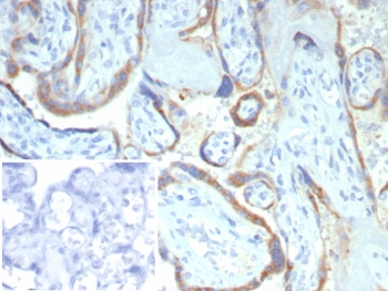 IHC staining of FFPE human placental tissue with Matrix metalloproteinase 2 antibody (clone MMP2/4586). Inset: PBS used in place of primary Ab (secondary Ab negative control). HIER: boil tissue sections in pH 9 10mM Tris with 1mM EDTA for 20 min and allow to cool before testing.~