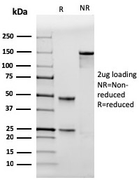 SDS-PAGE analysis of purified, BSA-free TP53 antibody